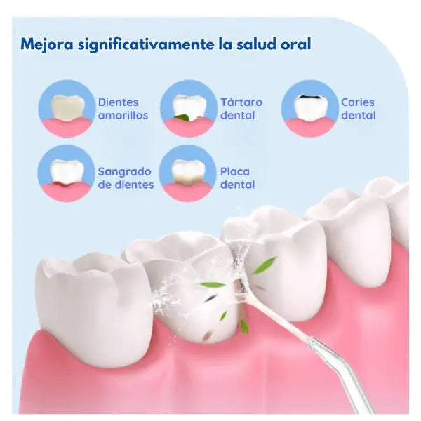 Portable Oral Irrigator for professional-level dental care at home